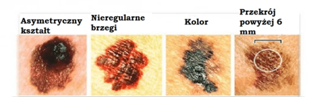 dwatro-czerniak-slownik