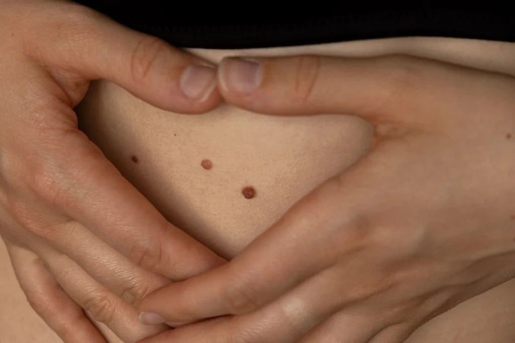 dwatro-czerniak-slownik